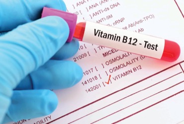 Study Confirms B12 Deficiency Risk From Metformin   PPN0323 020 13946 Blurb Lead 